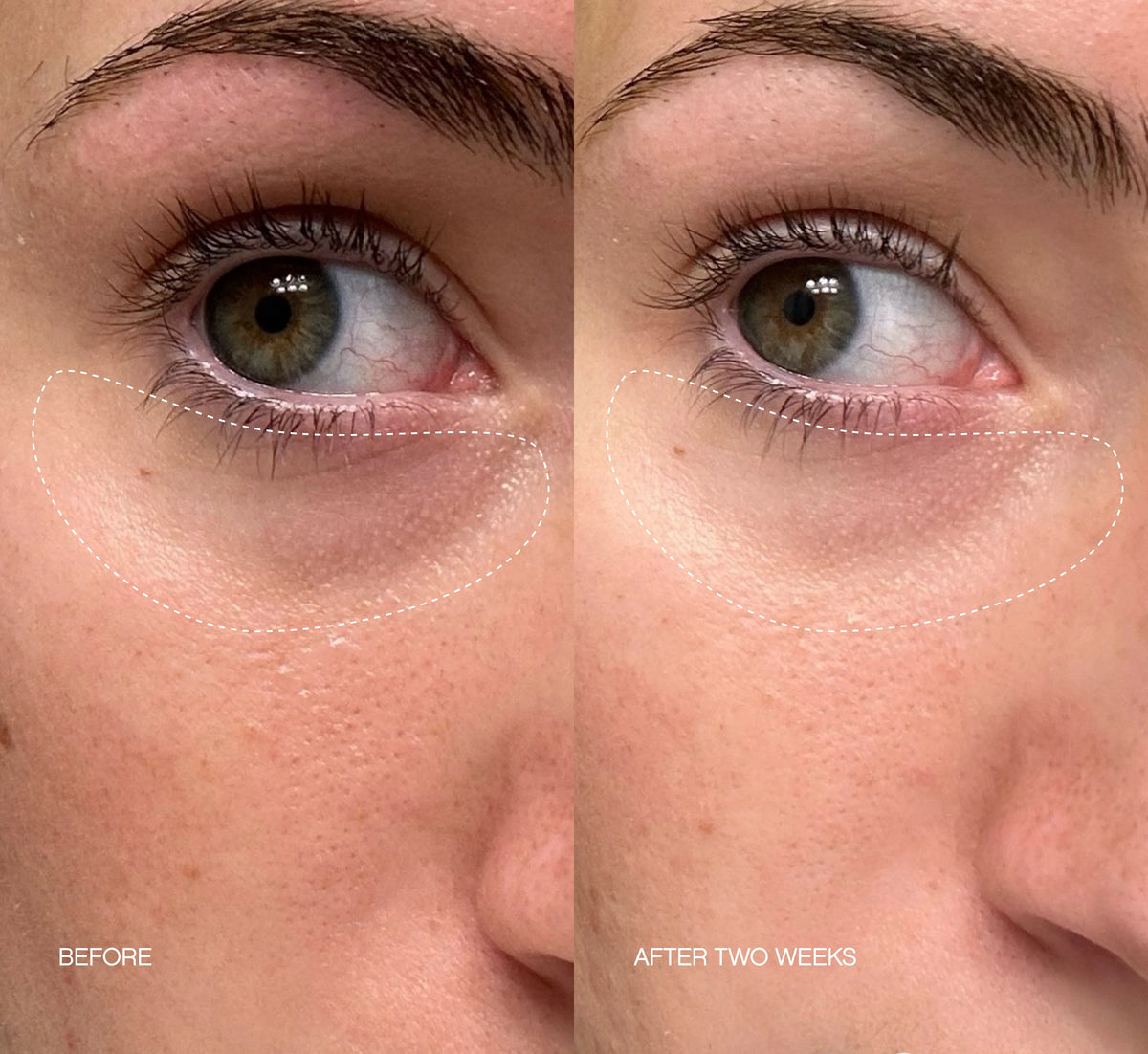 Faded Complete Dark Spot Bundle