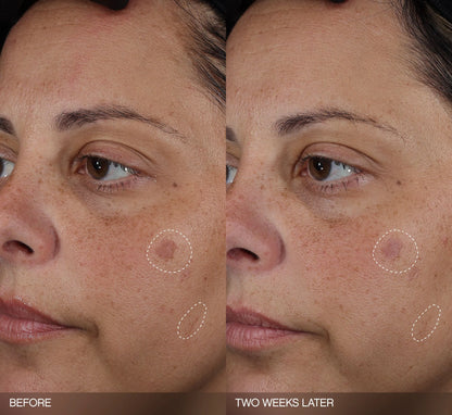Faded Complete Dark Spot Bundle