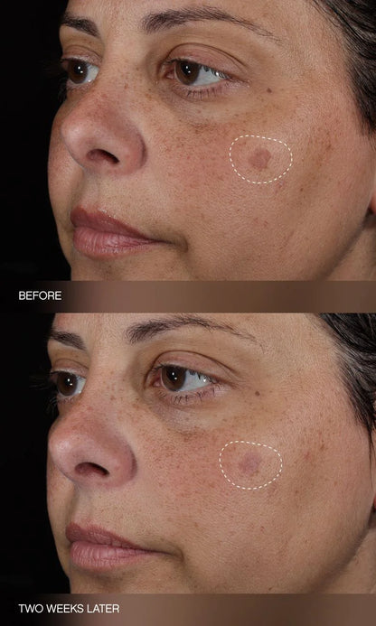 Faded Complete Dark Spot Bundle
