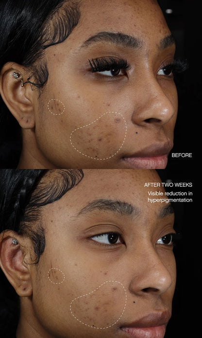Discoloration Duo
