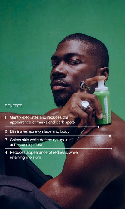 Clearly Acne Mist