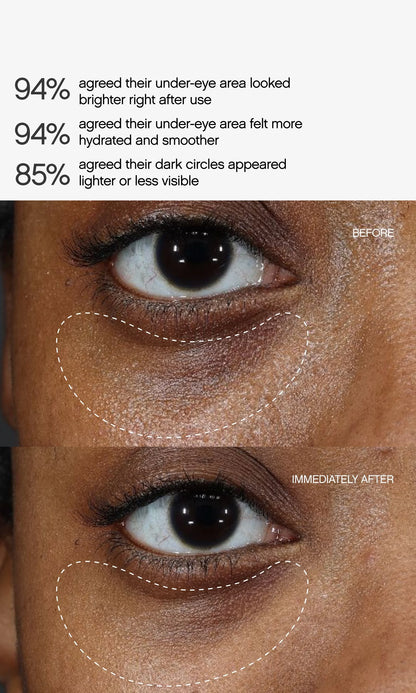 Faded Under Eye Masks