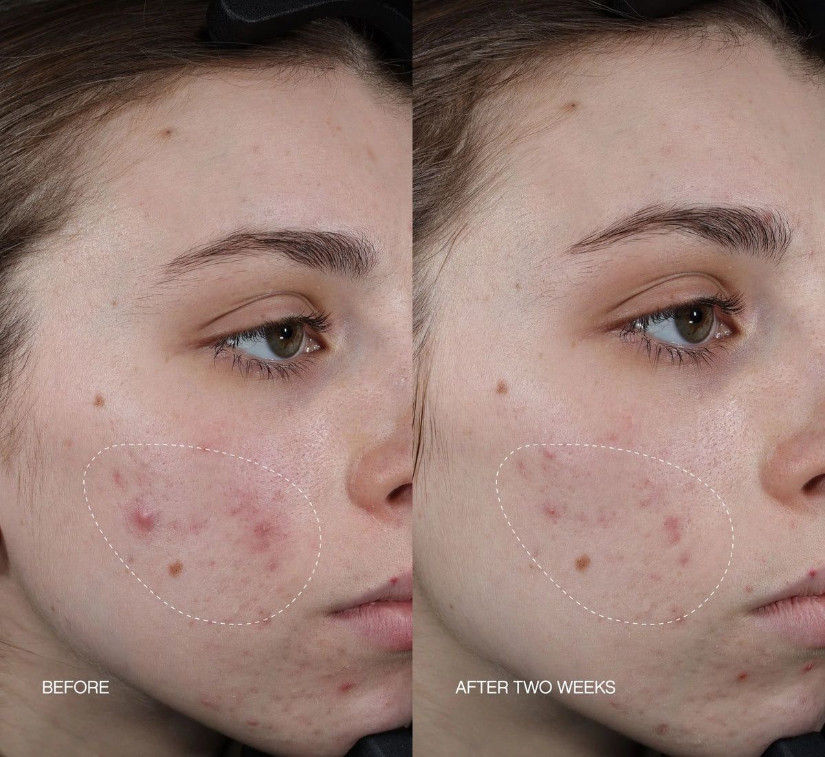 Faded Brightening + Clearing Serum