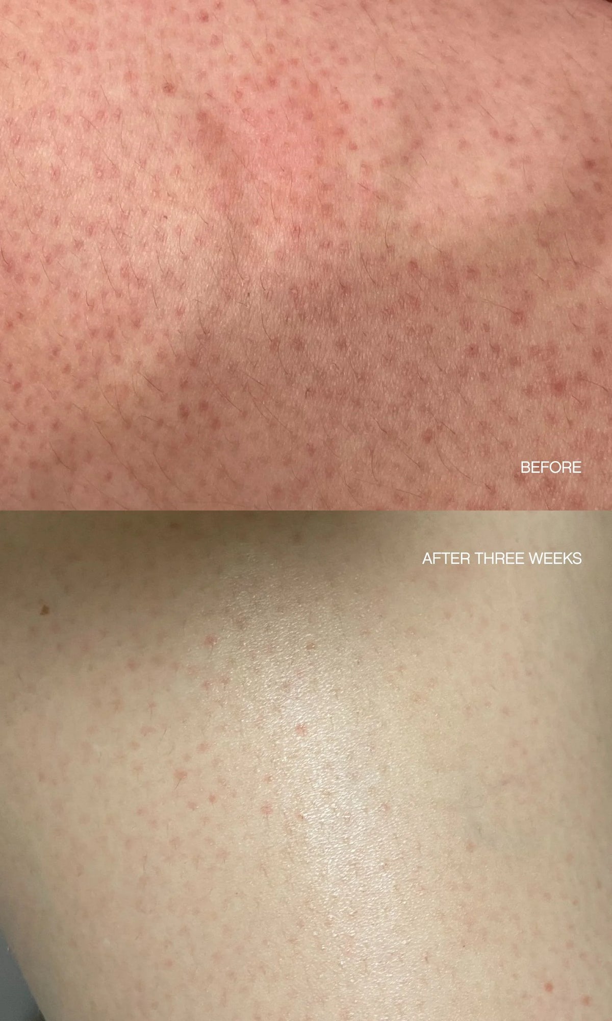 Slather Exfoliating Body Serum