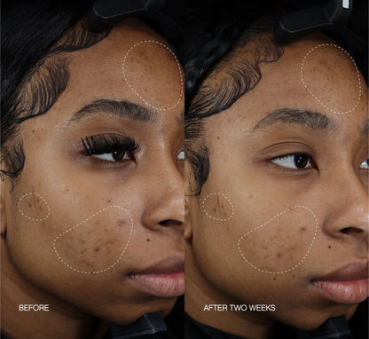 Faded Brightening + Clearing Serum