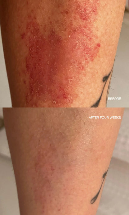 Discoloration Duo